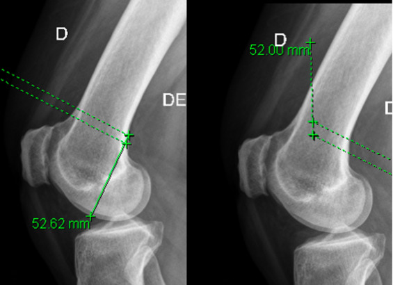 degorgement-wcormoy-1 Dégorgement wc à Ormoy-la-Rivière (91150) : solution rapide pour des toilettes débouchées efficacement